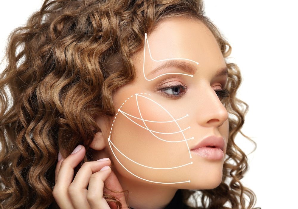 biostimolazione fili