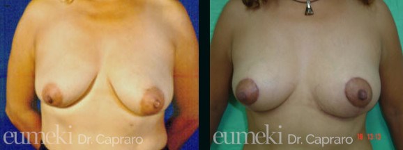 mastopessi1-front-desk1