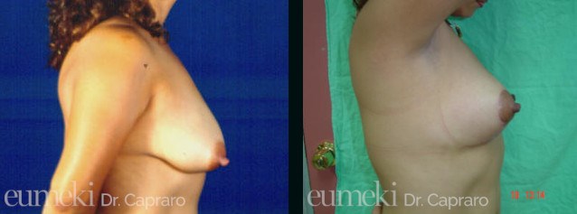 mastopessi1-latodx-desk1