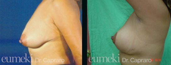 mastopessi1-latosx-desk1