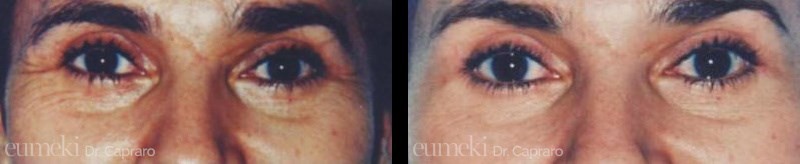 ringiovanimento1-desk